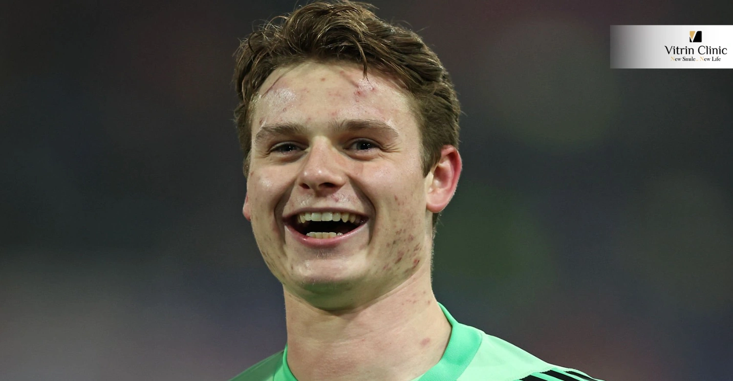 Cosa Rivela il Sorriso di Jonas Urbig sulla Sua Ascesa nel Calcio?